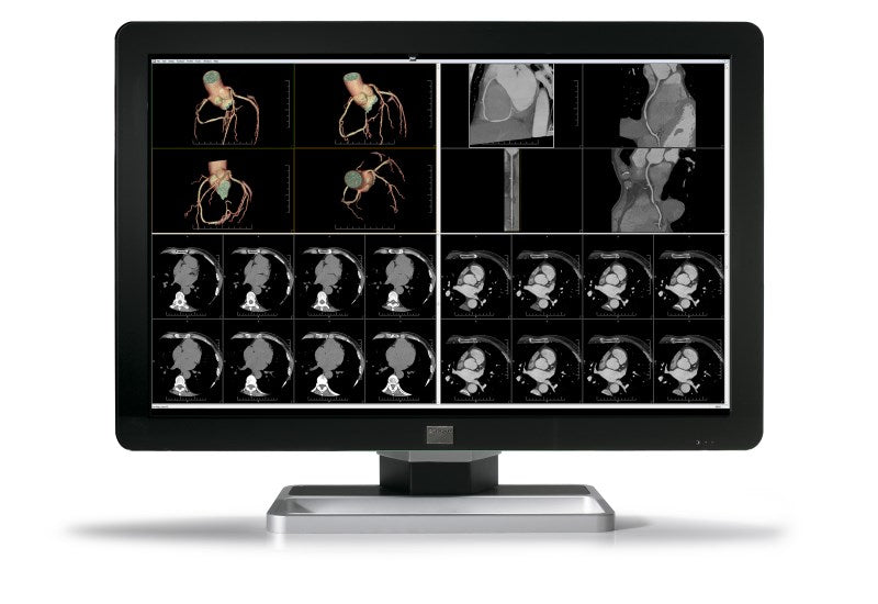 COR C F 6MP NC 30"1H1F EXCL DC 30"