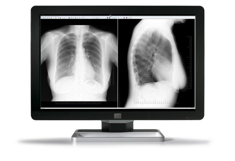 COR C F 6MP NC 30"1H1F EXCL DC 30"