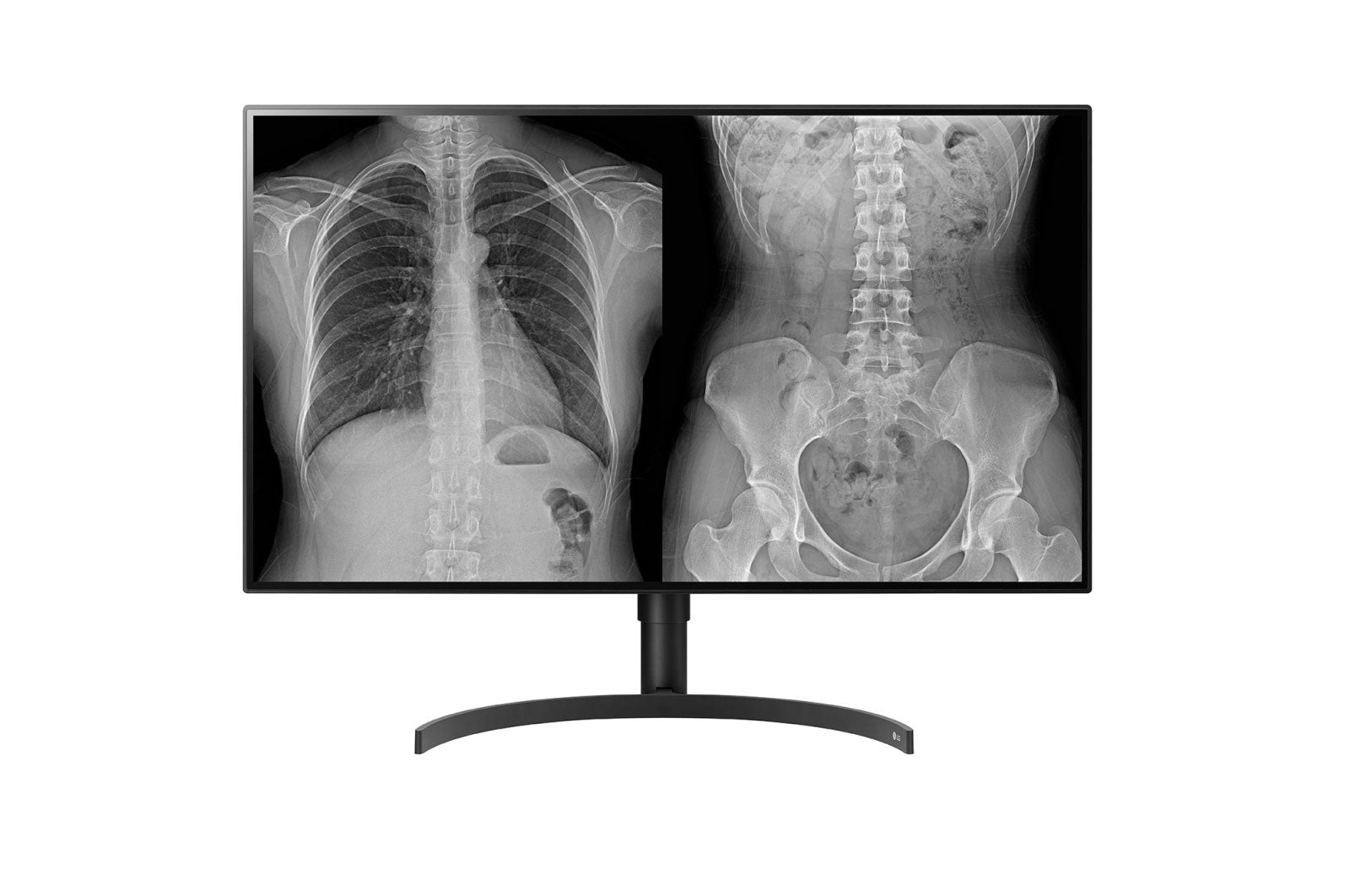 LG 32HL512D-B écran plat de PC 80 cm (31.5") 3840 x 2160 pixels Full HD LCD Noir