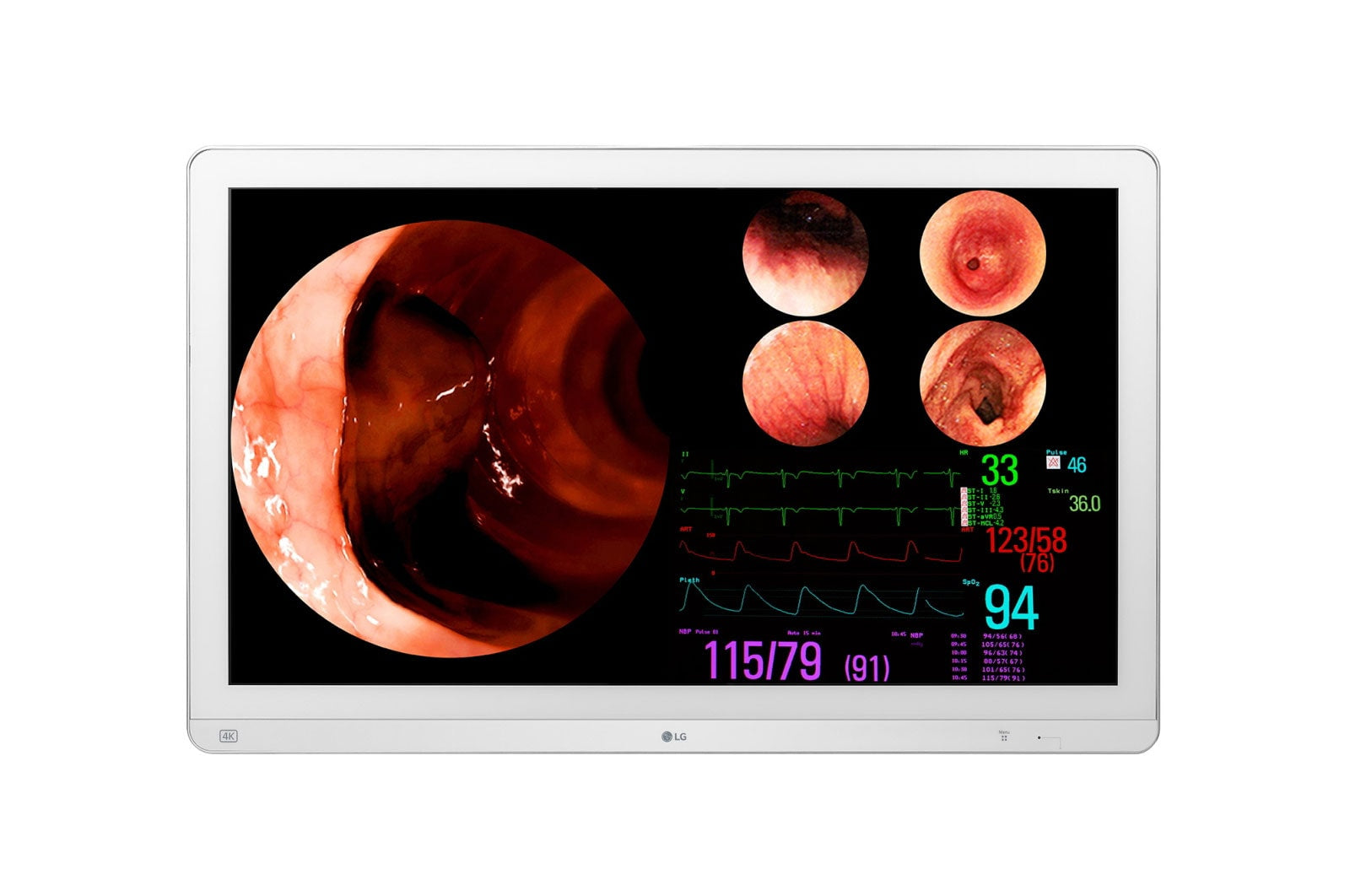 Surgical Monitor 31.5 80.01 cm 4K IPS