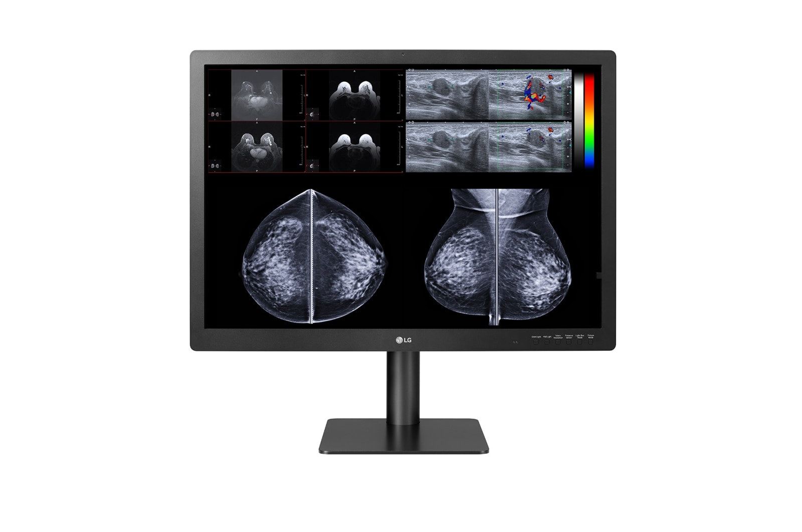 31'' 12MP IPS Diagnostic Monitor Mammogr