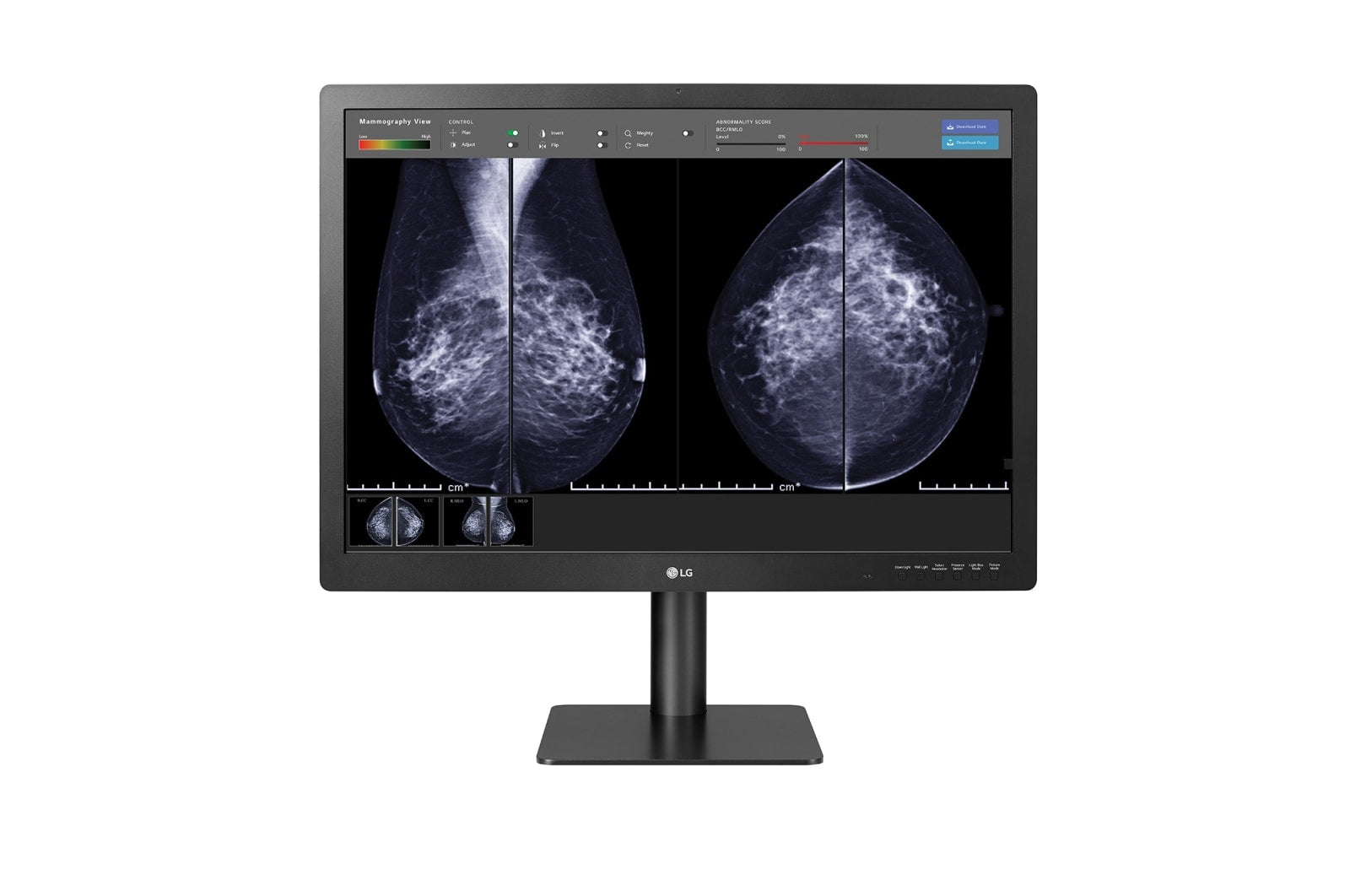 31'' 12MP IPS Diagnostic Monitor Mammogr